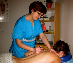 Moxa de artemisa se aplica calor en la propia contractura y en puntos de acupuntura