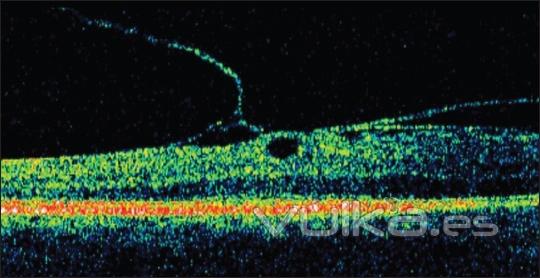 facil diagnostico-tratamiento rapido y eficaz