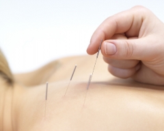 La acupuntura es el metodo mas efectivo de curacion para problemas musculares y articulares,