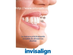 Ortodoncia invisible invisalign