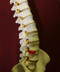 Algias de la columna vertebral - osteopatia