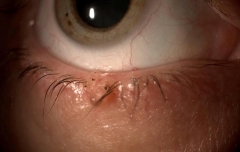 Clinica ocular estepona   dr rodriguez chico    - foto 8