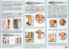 Triptico poliortesis en fibra de carbono