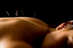 Relajacion y salud con acupuntura