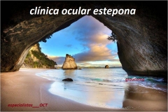 Glaucoma y oct