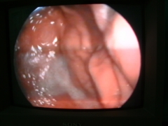 Diagnostico por imagen - videoendoscopia